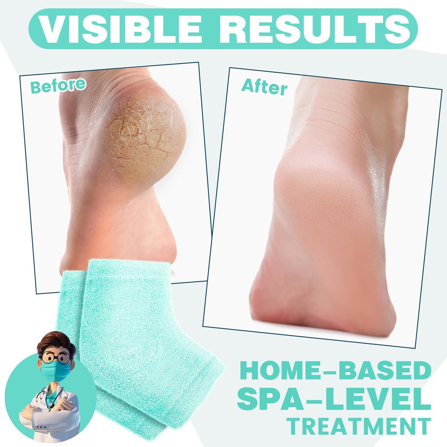 TEAWOO 3 Pairs Fuzzy Moisturizing Heel Socks for Dry Cracked Feet Women, Cracked Heel Repair, Cracked Heel & Dry Foot Treatment (Mint Green)