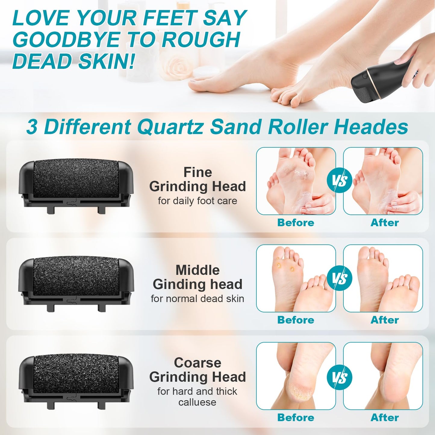 8 Pack Refill Rollers for Electric Foot Callus Remover, Replacement Rollers Heads Foot Care Pedicure Tools, 3 Pack Extra Coarse, 3 Regular Coarse, 2 Gentle Coarse Refill Rollers for Electric Foot File