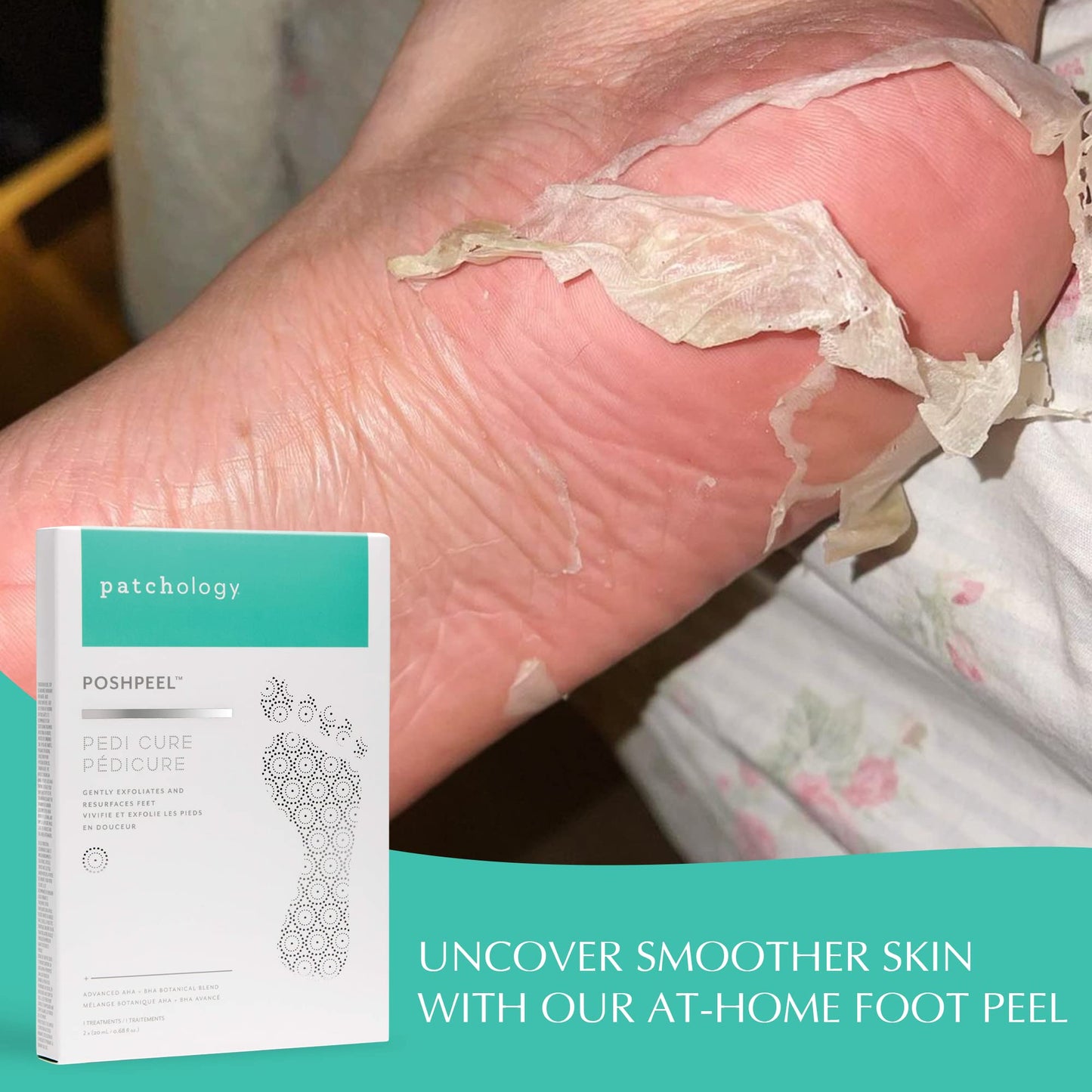 Patchology PoshPeel Pedi Cure - Foot Peeling Mask Soak Treatment, Feet masks for dry cracked feet, Pedicure Booties w/Deep Exfoliation for Baby-soft Skin, Pedi Supplies for Foot Care, 1 Pair