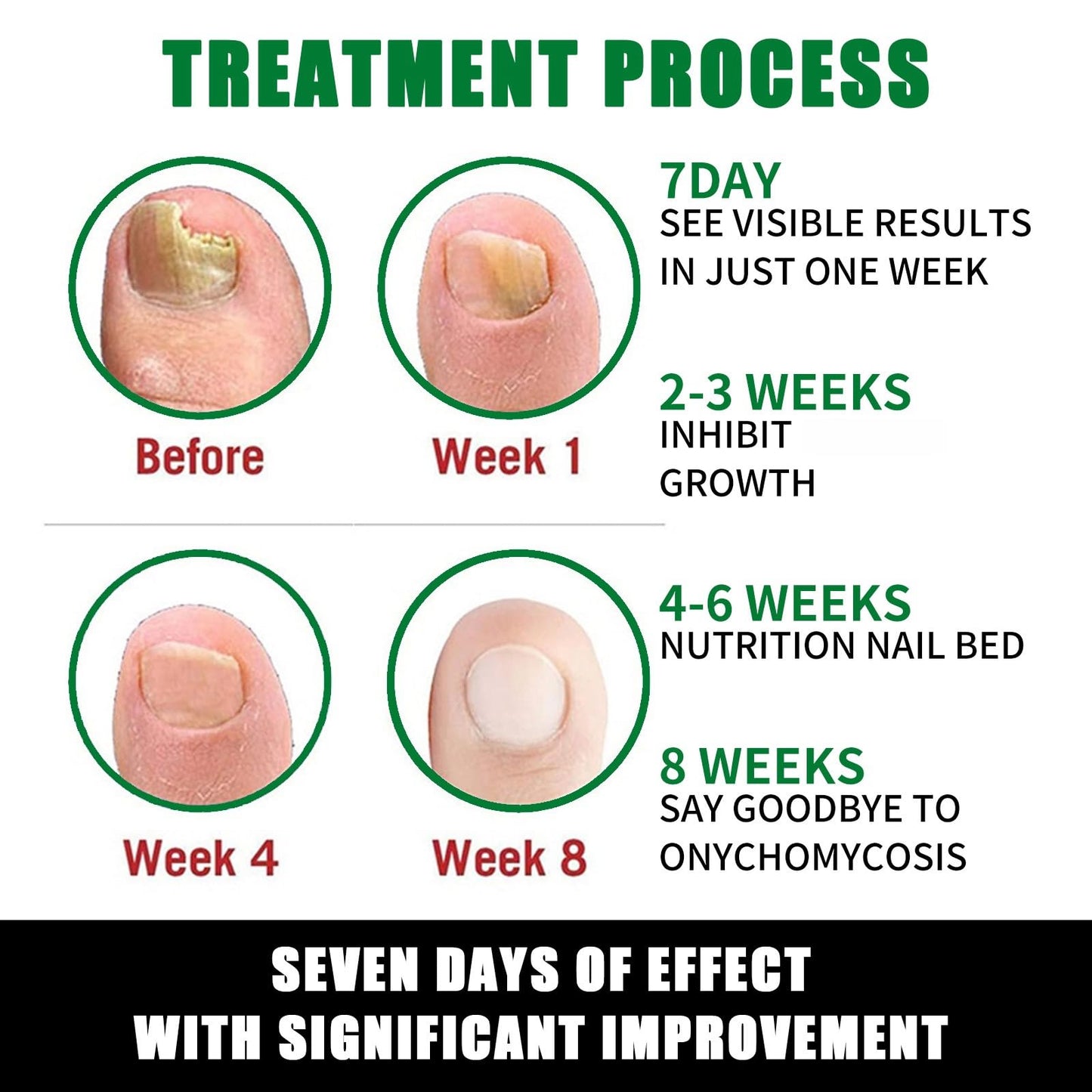 7 Days Ginger Foot Spray, 7 Days Nail Repair, 7 Days Ginger Nail Treatment, Ginger Nail Treatment (3pcs)