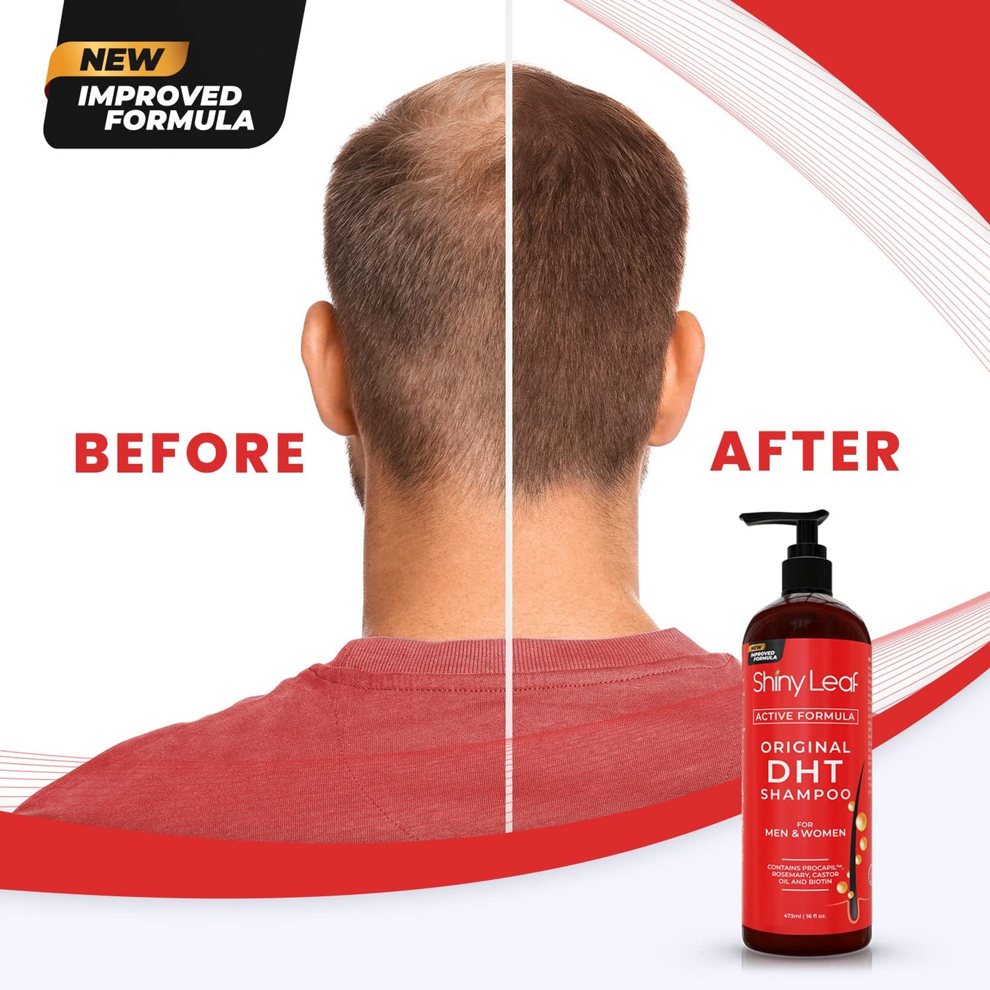 DHT Blocking Shampoo for Hair Growth and Thinning Hair Treatment - Active Natural Formula, Reduces Shedding for Men & Women (2 Pack)