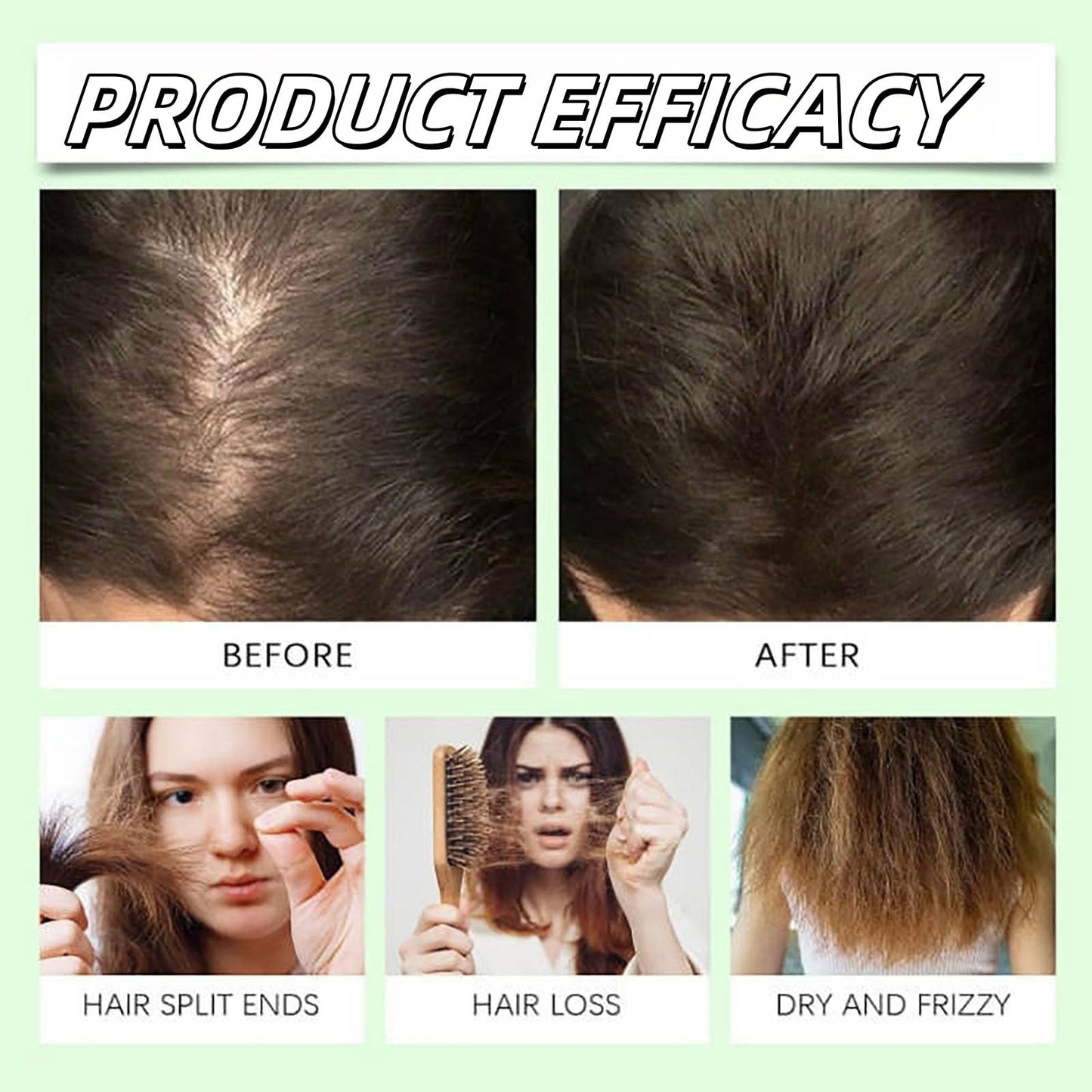300ml Remimpi Anti Hair Loss Shampoo for Women, Remimpi Anti-Hair Fall Promote Hair Growth Shampoo, Remimpi Anti Hair Fall Hair Treatment Shampoo Oil Control Anti Dandruff Anti Hair Loss (1Pcs)