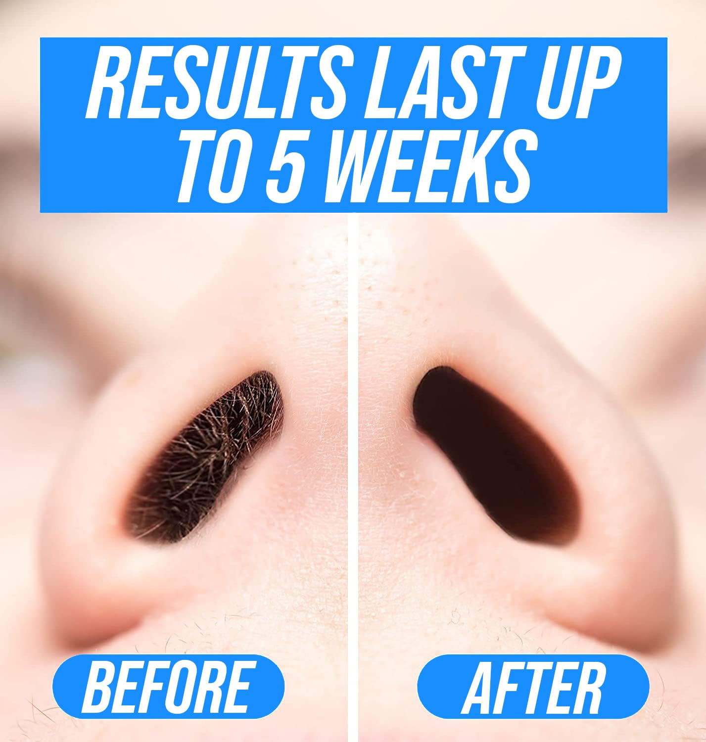 KENASHII Nose Wax Kit | 100 g Wax, 24 Applicators | Hair Removal Kit for Men and Women | Includes Balm Wipes and Mustache Guards | Lasts up to 5 Weeks