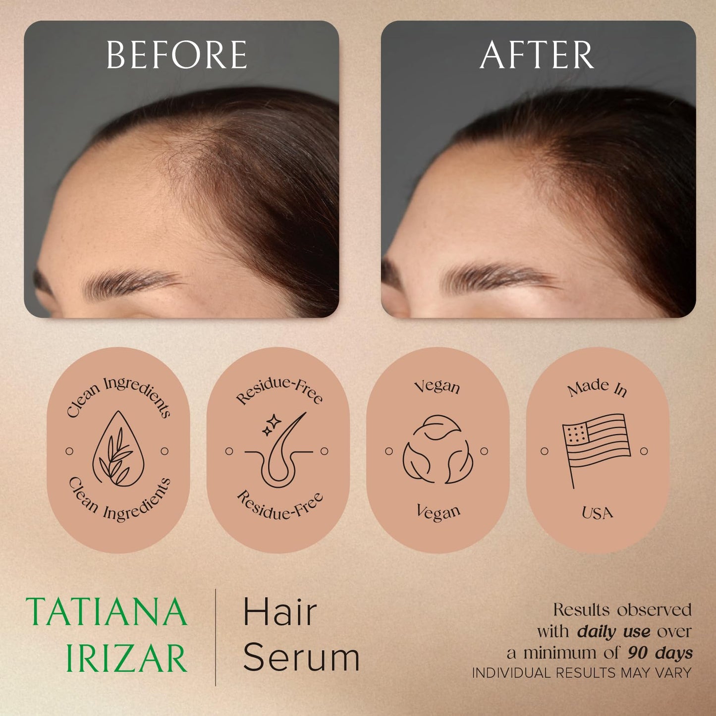 Hair Serum for Hair Growth Serum Women Made in USA - 2 Pack Scalp Serum for Hair Growth Non-Greasy Rosemary & Amla Hair Care Vegan 1 Oz Hair Loss Treatment for Women Hair Regrowth Treatment for Women
