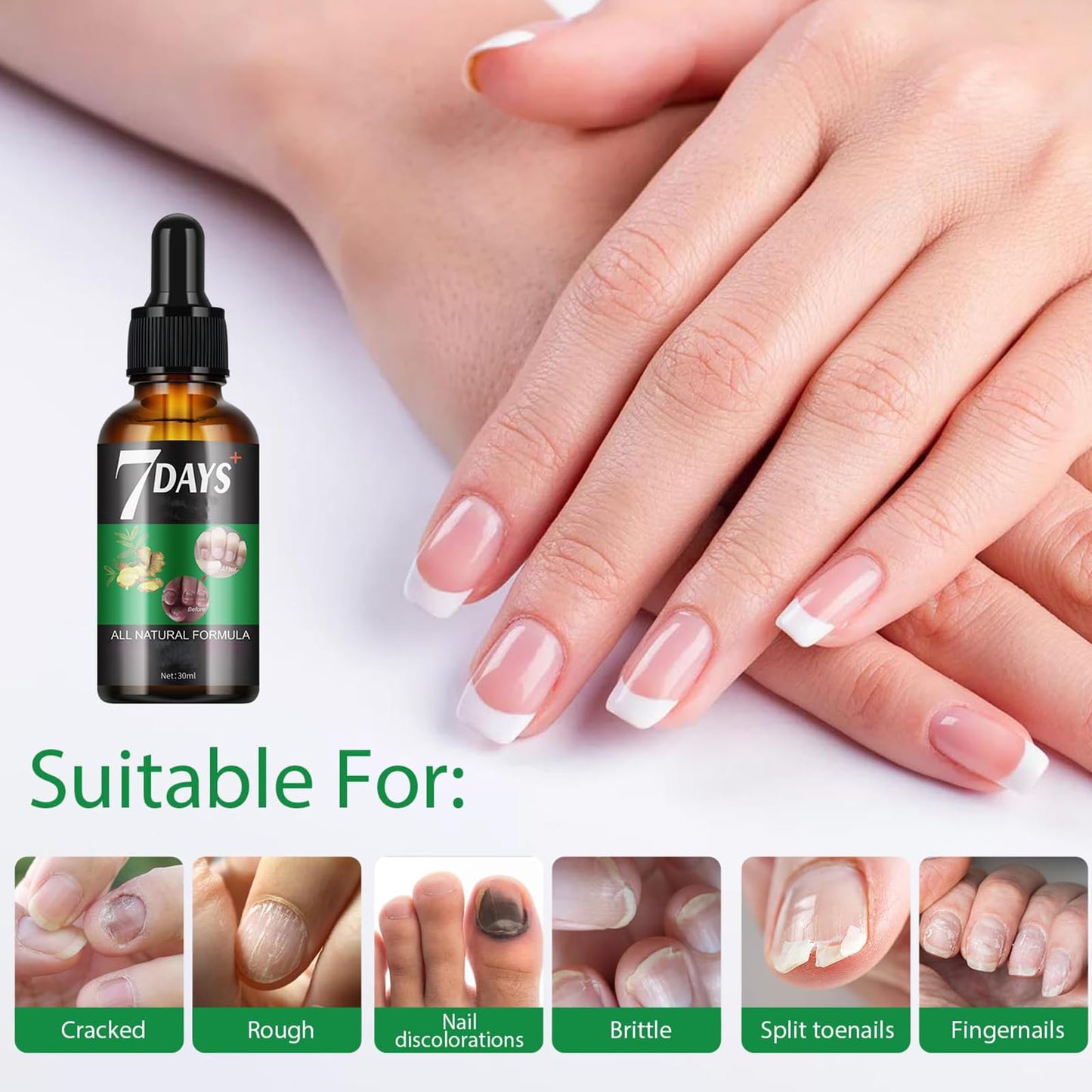 Ginger Nail Treatment Nail Growth Serum, Ginger Nail Growth Oil for Damaged Nails - Repair and Strengthen for Glowing, Beautiful Nails 30ML / 1.06OZ (1 PCS)