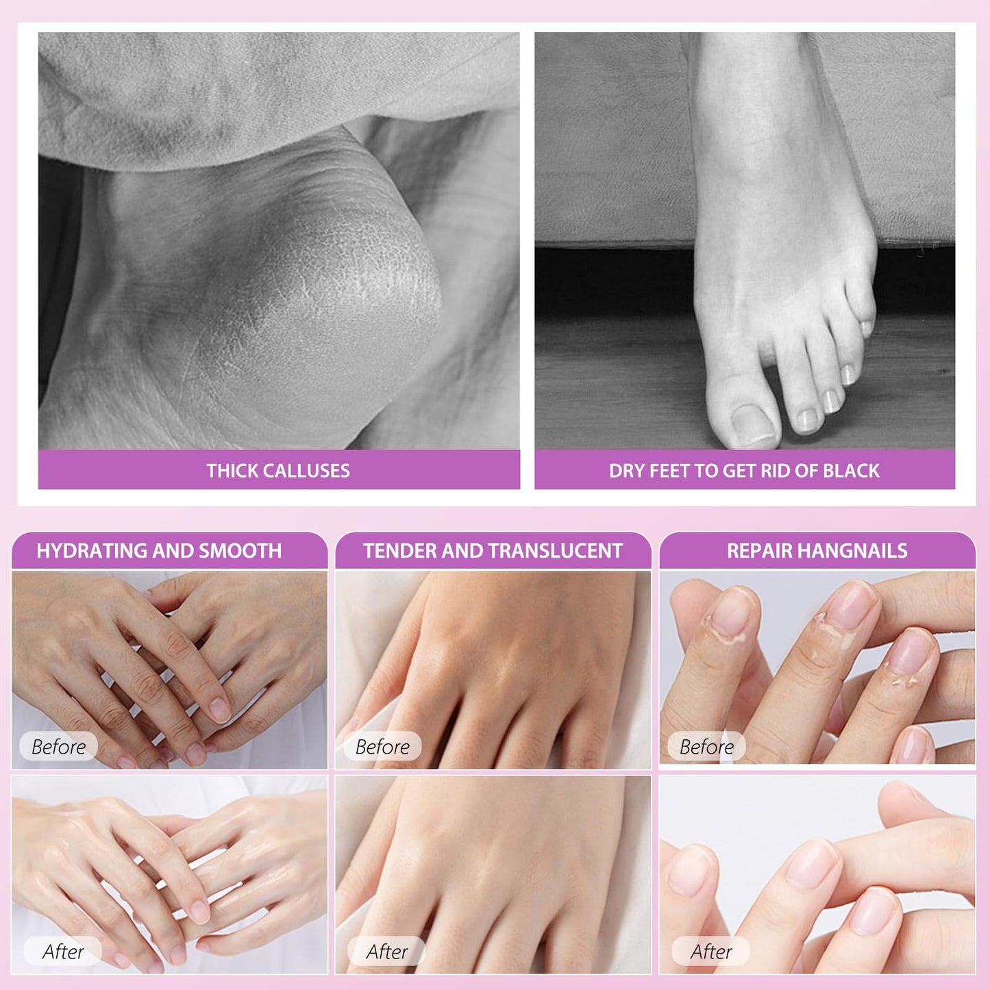 GUOYAOLIFU Hydrating Hand Foot Masks Set,Moisturizing Hand Mask for Dry Hand,Exofliating Foot Mask for Peeling Away Dead Skin Calluses,5 Pack Glove Mask&5 Pack Socks Mask for Women（Lavender）