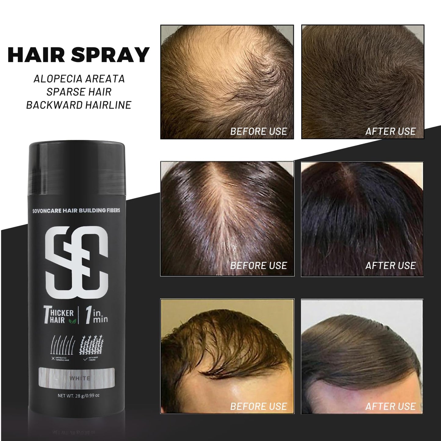 SOVONCARE Hair Fibers for Thinning Hair White, Hair Building Fibers for Bald Spots Undetectable & Natural, Conceals Hair Loss Fill In Fine, Hair Powder Hair Thicker Instantly for Women & Men 28g