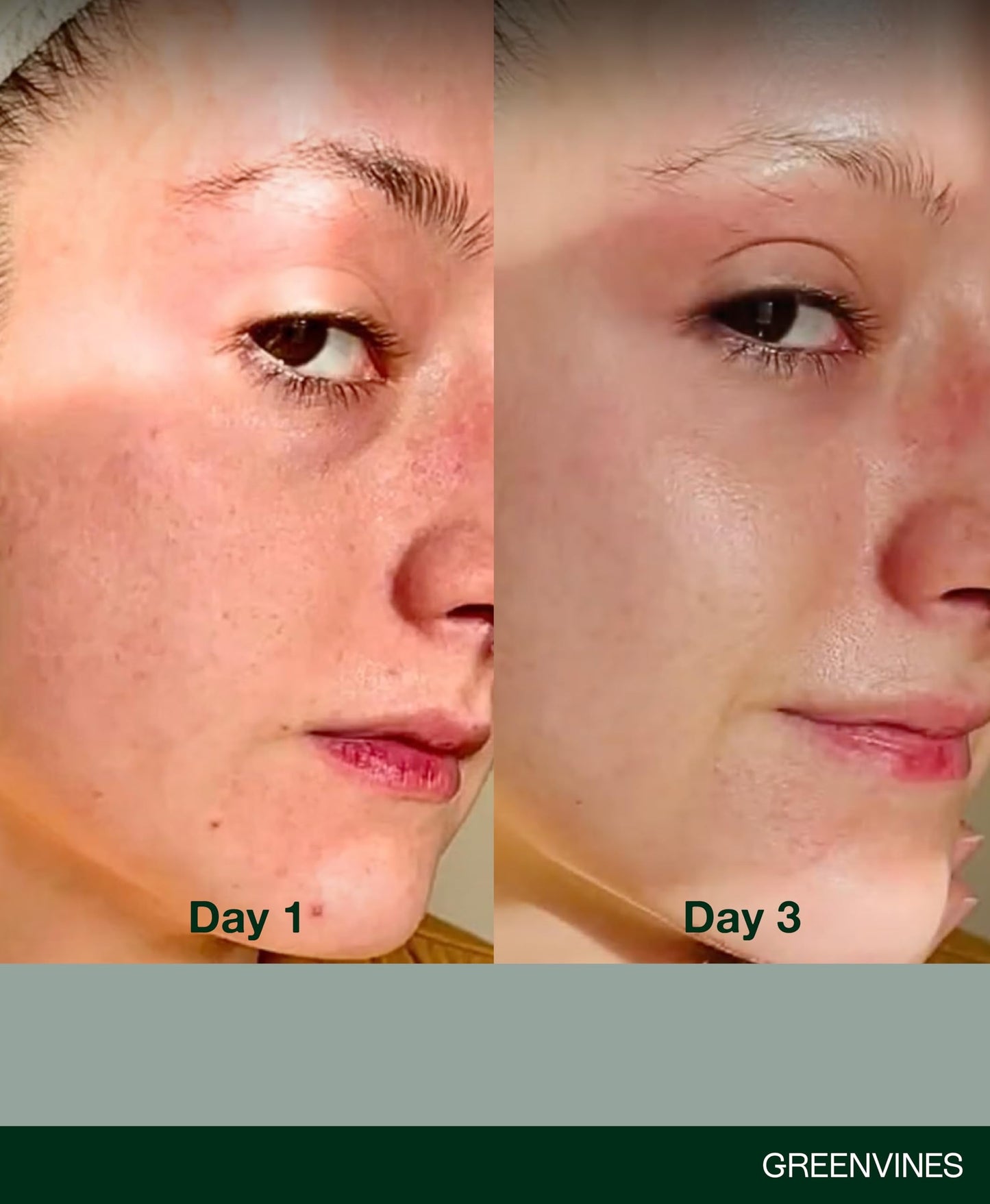 Greenvines Luminosity Hydrated & Anti-Aging Serum | Prevent Pre-mature Aging Sign for Smooth, Radiant Skin | Sensitive, Damaged Skin Work | 0.3 Fl oz