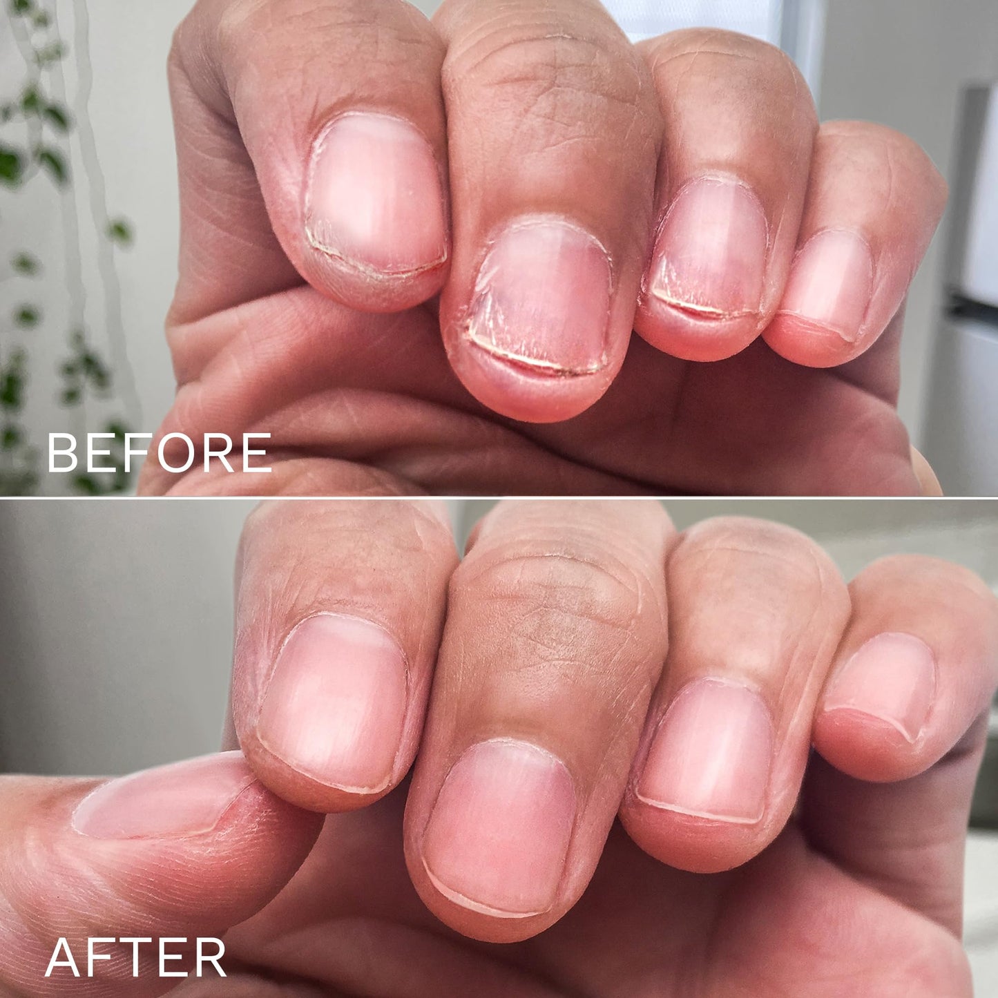 LONDONTOWN No Bite Nail Recovery - Nail Biting Prevention and Thumb Sucking Deterrent Invisible Finish, Non Toxic Bitter Aftertaste Nail Growth Treatment, .40fl oz