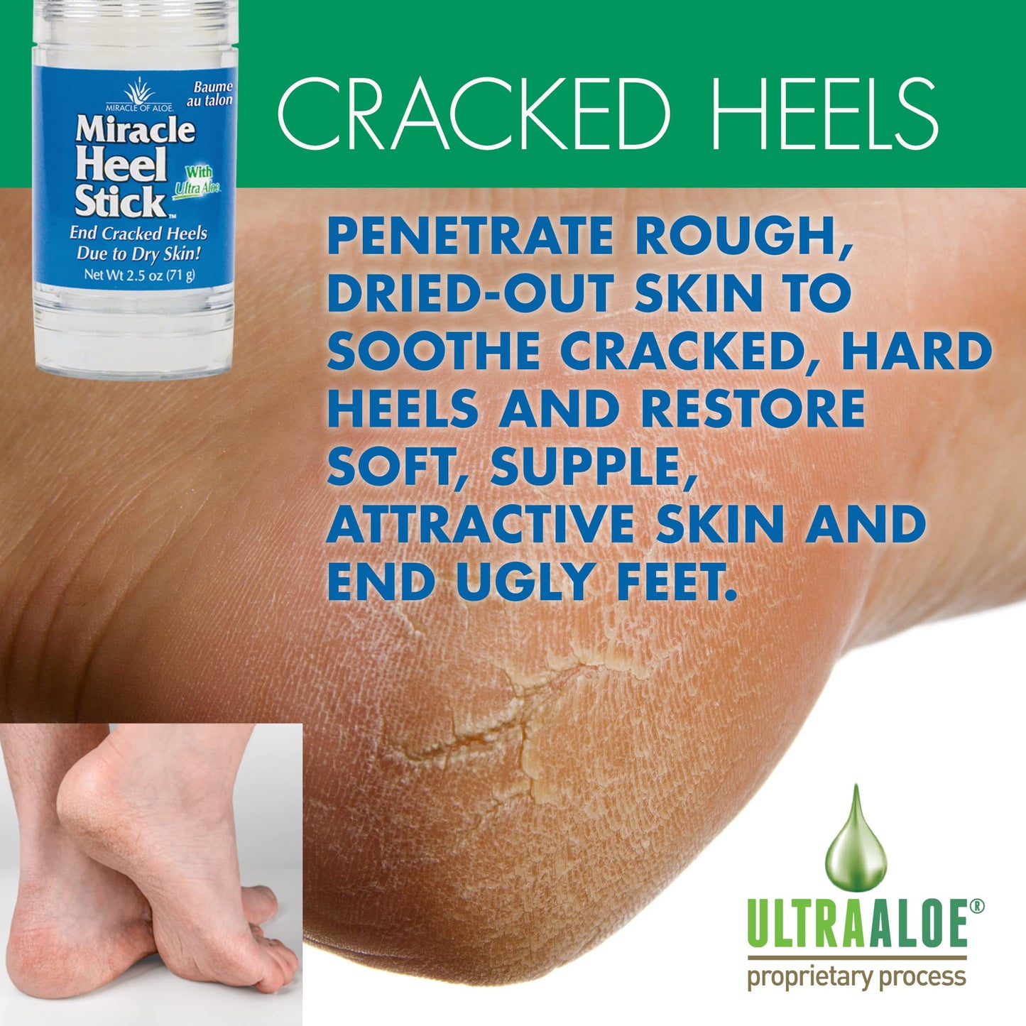 2-Pack Miracle Heel Stick with Pure UltraAloe Aloe Vera Gel | 2.5 ounce stick