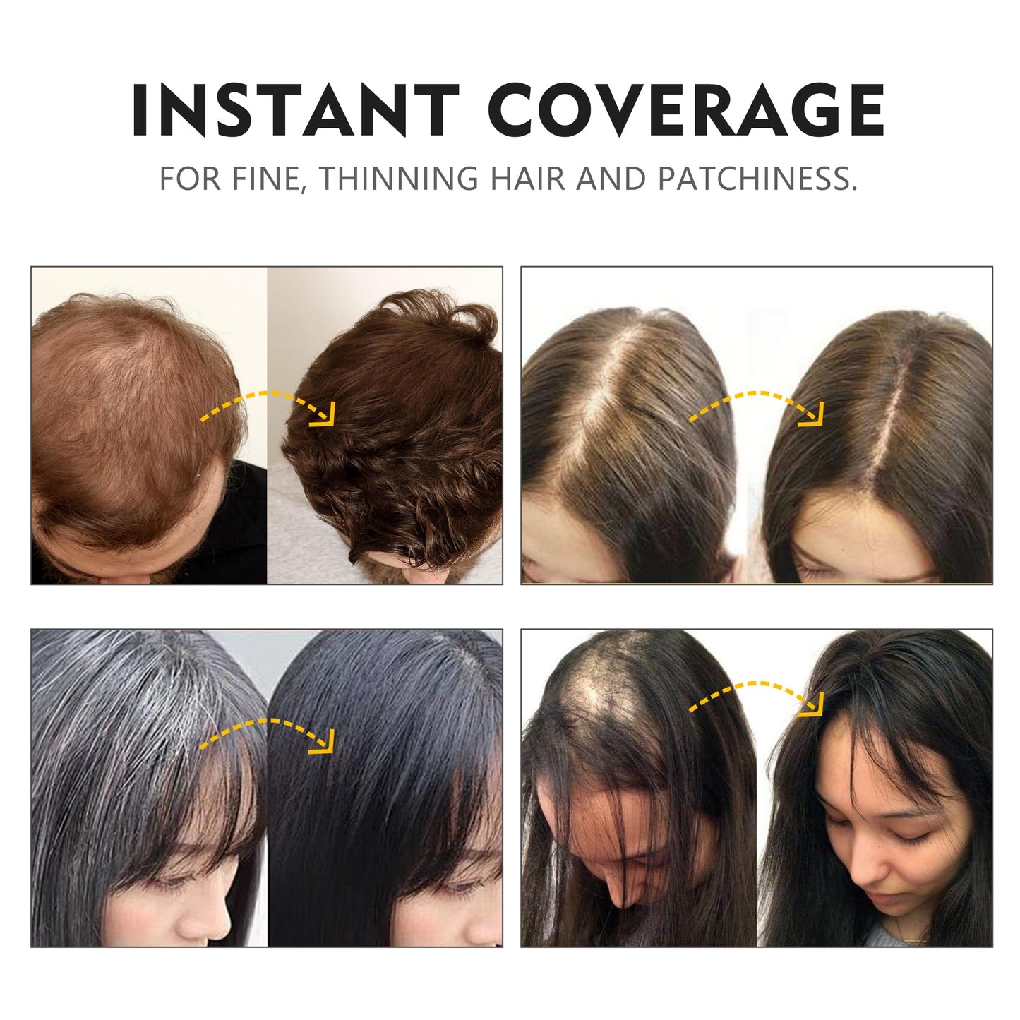 NIZORICK Hair Fibers for Thinning Hair,Hair Building Fibers Instantly Thicker & Fuller Look,Conceals Hair Loss Fill In Fine Hair Powder for Women and Men(30g/1.05oz) (New Black)