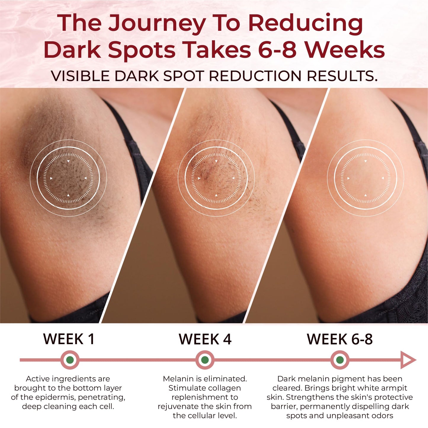 ABERA Dark Spot Corrector Cream for Face, Body & Sensitive Areas, Dark Spot Remover with Arbutin & Niacinamide, Even Skin Tone,1.7 Oz, Set of 2