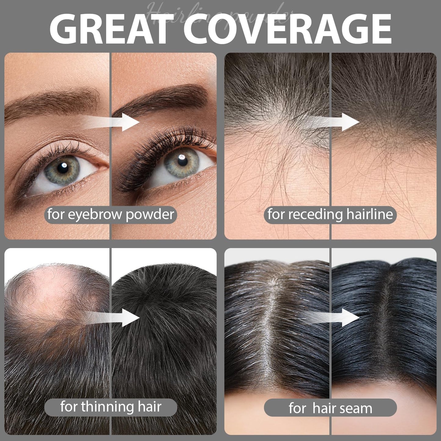 2 Pack Hairline Powder for Women and Men, Used to Root Touch Up Hair Color, Thinning and Gray Hair Coverage and Bald Spots Coverage, Black