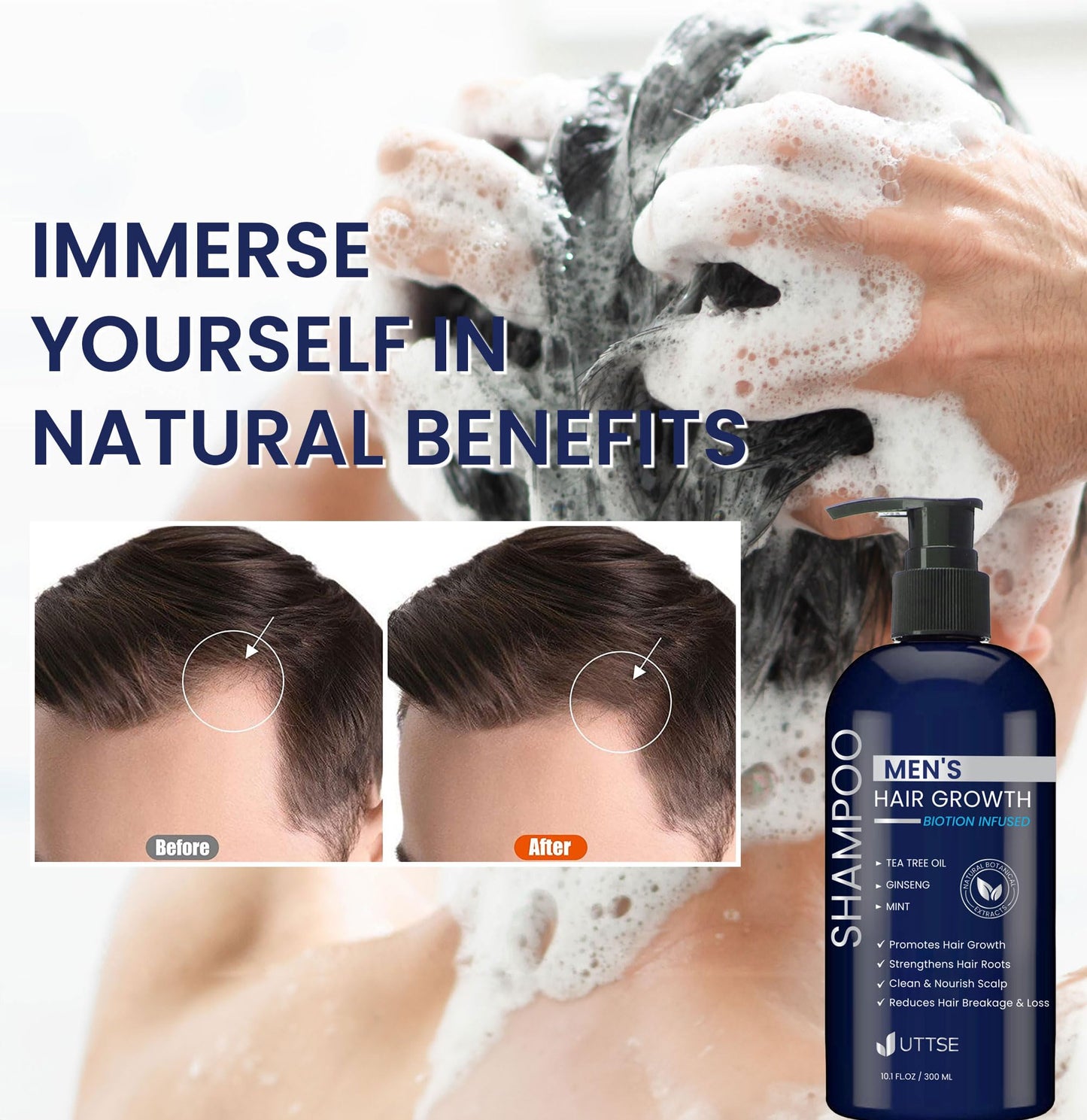 Uttse Biotion Hair Growth Shampoo for Men: Natural Thickening Shampoo with Tea Tree Oil Ginseng Mint for Hair Loss and Thinning Hair - 10.1 fl.oz, Dark Blue