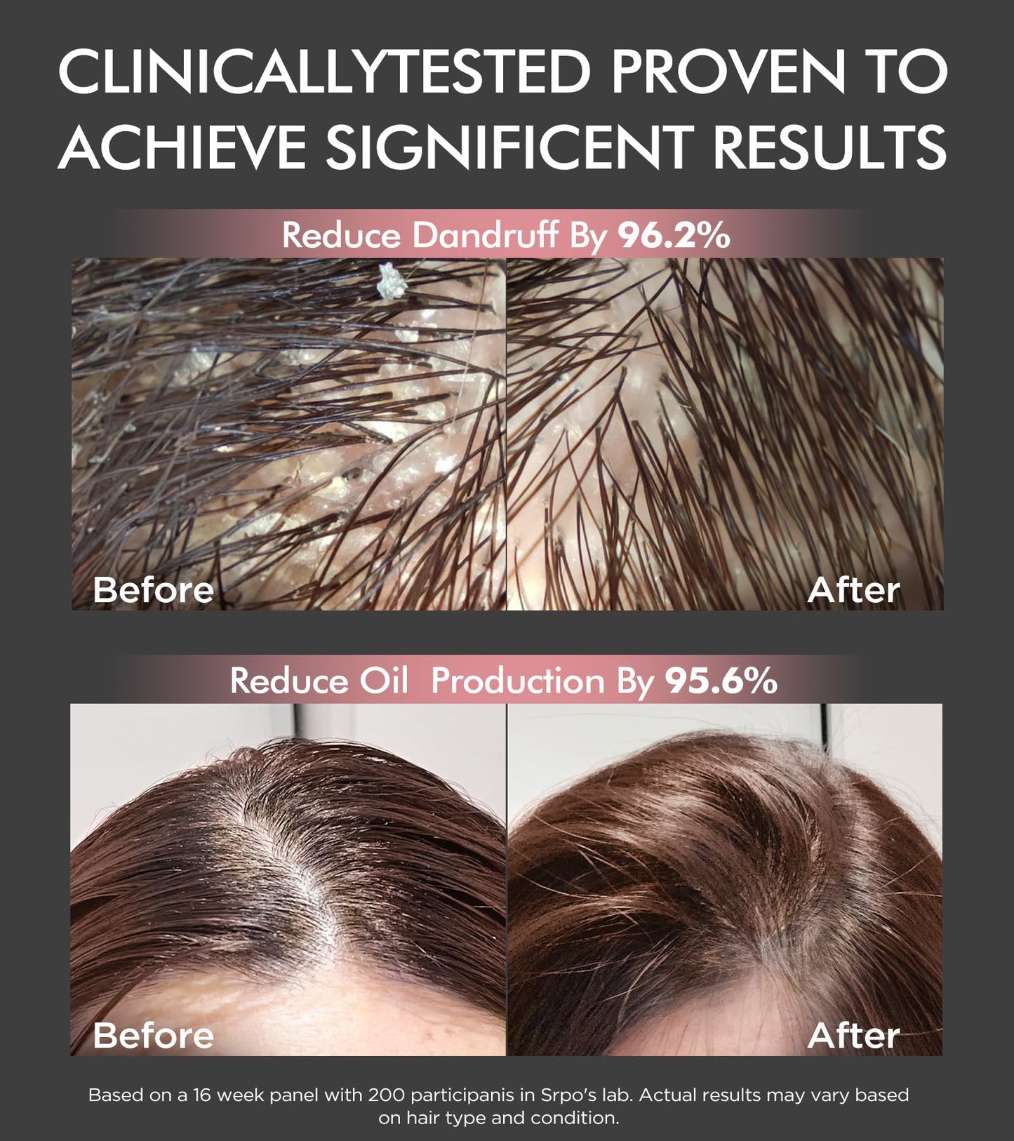 Tripeptide-Infused Hair Growth Biotin Shampoo and Conditioner Set, Onion Anti-Loss Volumizing Moisturizing Treatment for Soft Shine Hair, Rosemary Clarifying Dandruff Shampoo for Women Men, 2 x 16.9oz