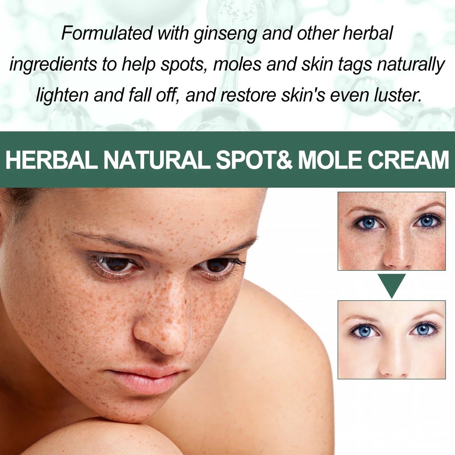 EELHOE Face Spot Remover Cream Moisturizing Brightening Skin Melasma Lightening Acne Marks Treatment Soothing Facial Skin Care