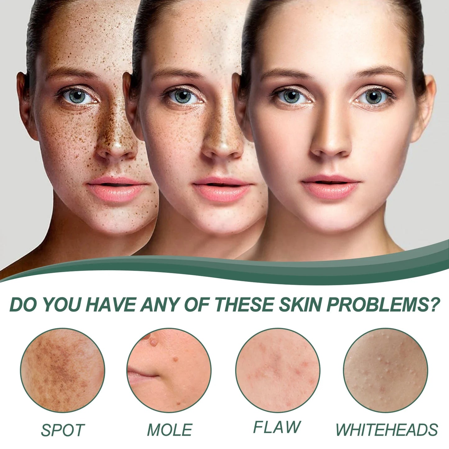 EELHOE Face Spot Remover Cream Moisturizing Brightening Skin Melasma Lightening Acne Marks Treatment Soothing Facial Skin Care