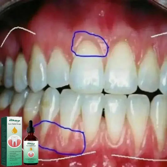 Gum Repair Drops Relieve Receding Gingival Swelling Gum Cleaning Care Oral Periodontal Hygiene Remove Yellow Tartar 2024 New