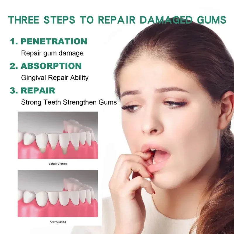 Gum Repair Drops Relieve Receding Gingival Swelling Gum Cleaning Care Oral Periodontal Hygiene Remove Yellow Tartar 2024 New