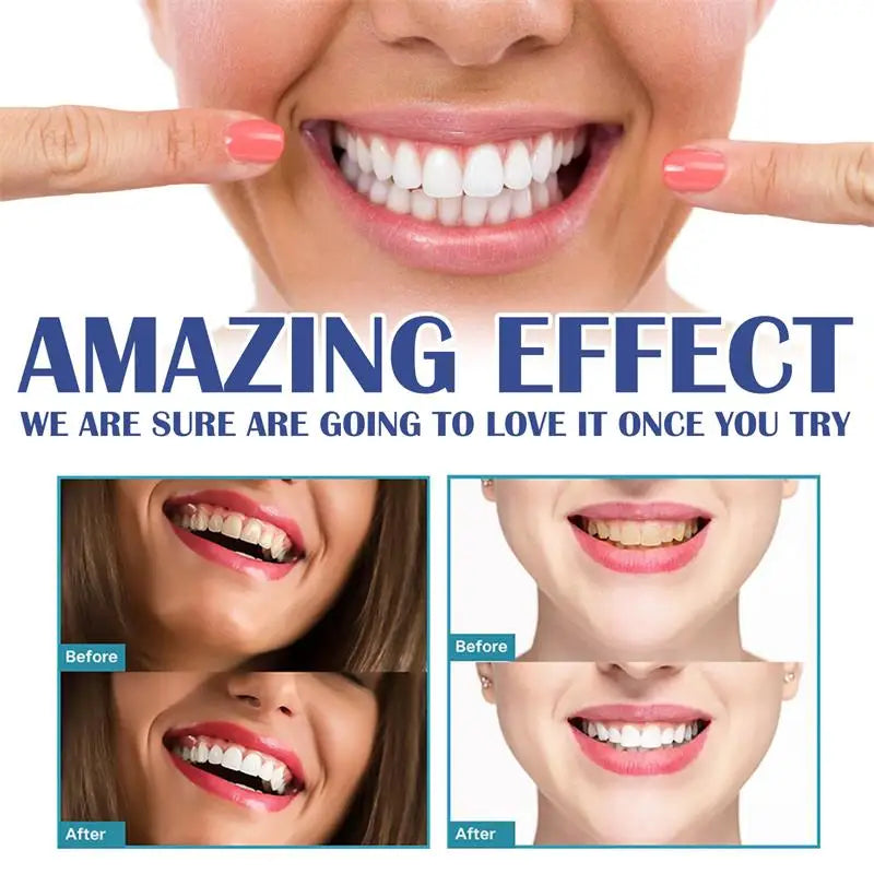 Gum Instant Treatment Gel Relieve Gingival Recession Swelling Pain Clean Plaque Stains Whiten Teeth Anti Gingival Inflammation