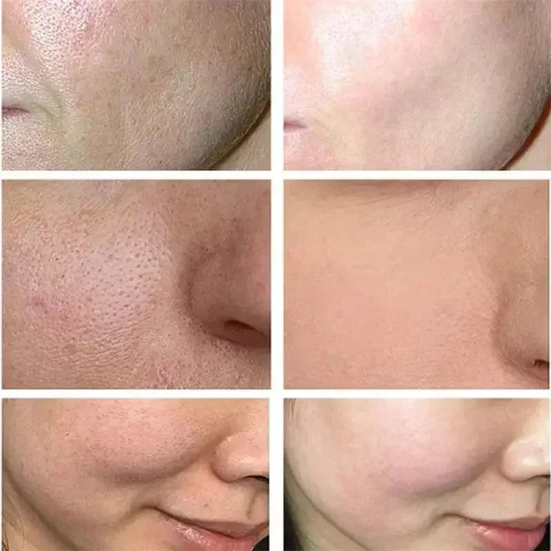 Sakura Whitening Face Serum Anti Aging Fade Fine Lines Tighten Pores Improve Melanin Pigment Dull Moisturizer Brighten Skin Care