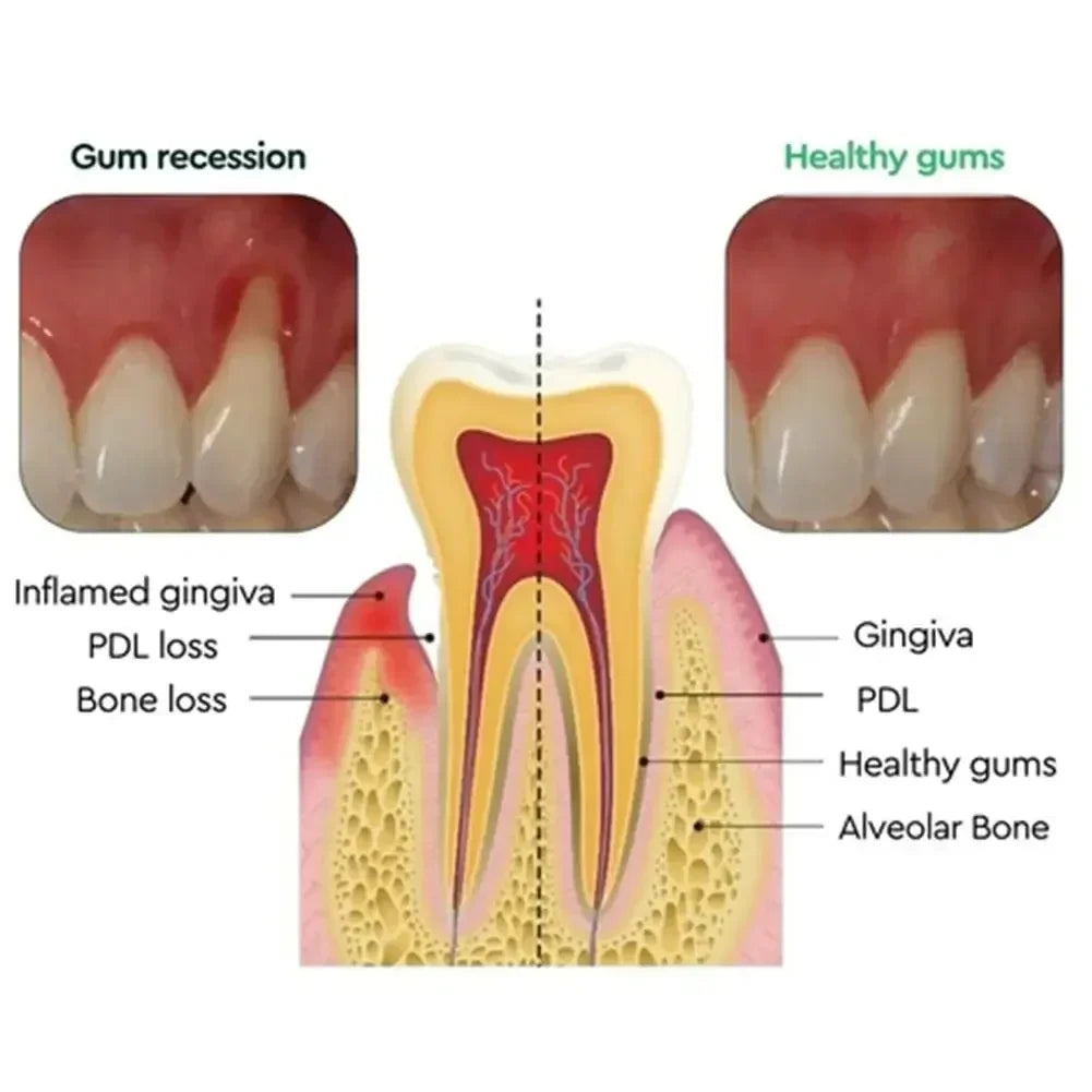 Gum Repair Drops Relieve Receding Gingival Swelling Gum Cleaning Care Oral Periodontal Hygiene Remove Yellow Tartar 2024 New